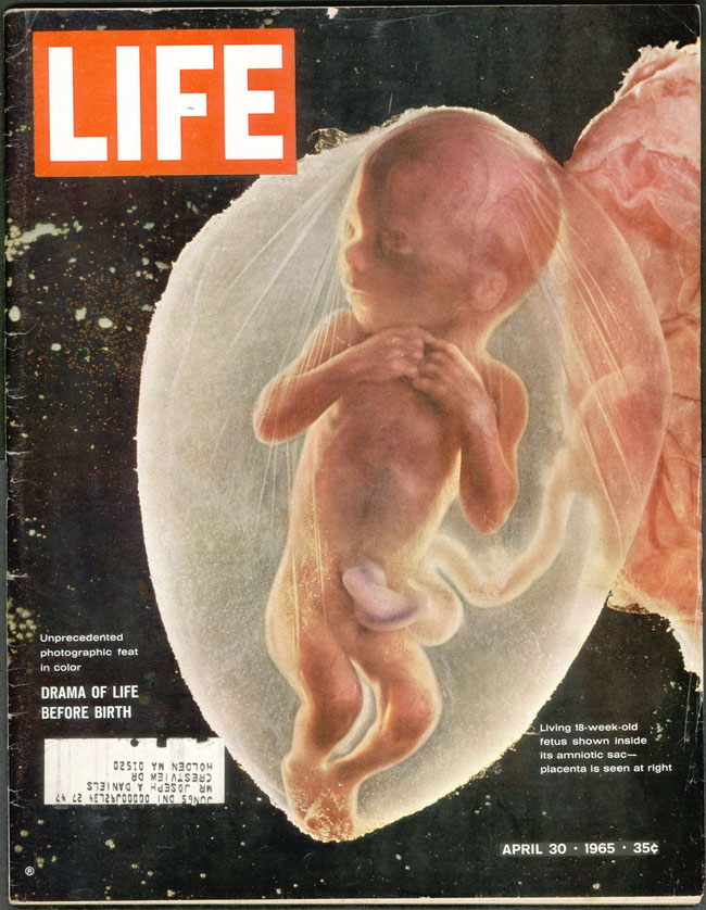 La famosa foto di un feto su Life. 