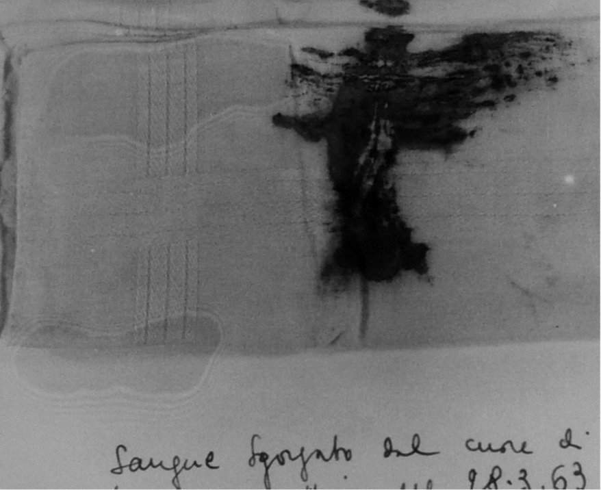 Fig. 4. Margherita: fazzoletto bagnato di sangue sgorgato dalla ferita al costato, ASDM, 1963.