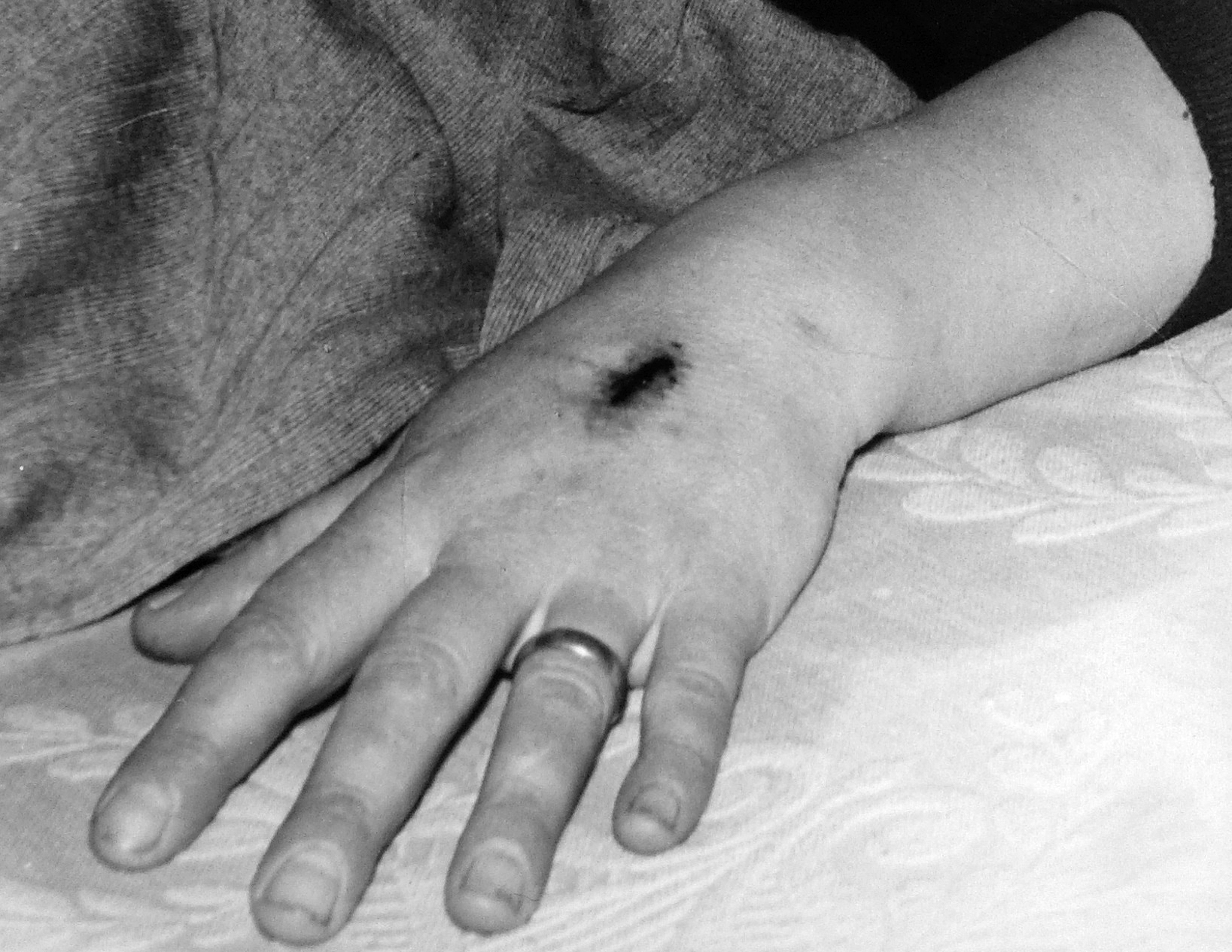 Fig. 5. Margherita: Stigmate, mano sinistra, ASDM, ca. 1962-63.